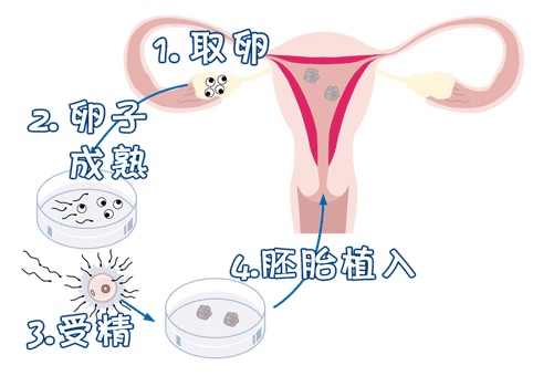 单身生子助孕机构